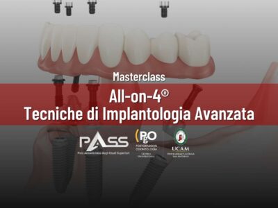 MASTERCLASS All-on-4®: Tecniche di Implantologia Avanzata